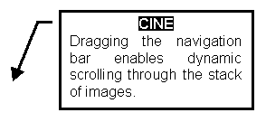 ���� ���� 3: CINE
Dragging the navigation bar enables dynamic scrolling through the stack of images.



